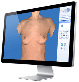 Breast Enlargement 3D Simulation